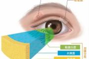 这个眼睛透支的信号，很多人没当回事！