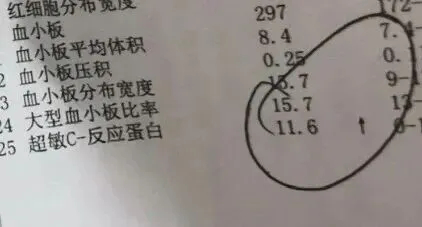 如何知道体内炎症水平高不高 如何知道体内炎症水平高不高